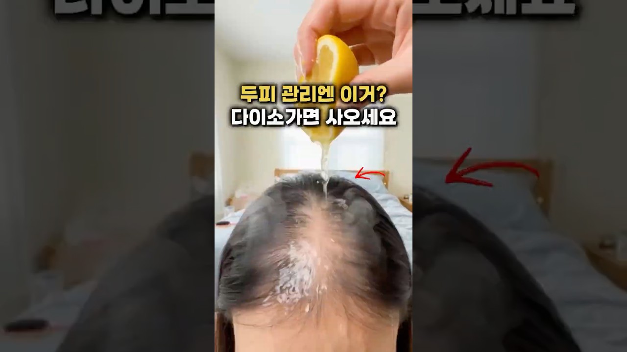와…모발이 엄청 많아졌는데요?