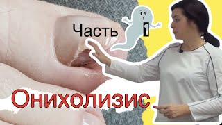 видео: Онихолизис - механические повреждения (самая крутая лекция в рамках ютуба) #podolog#goloh#онихолизис картинка: Онихолизис - механические повреждения (самая крутая лекция в рамках ютуба) #podolog#goloh#онихолизис
