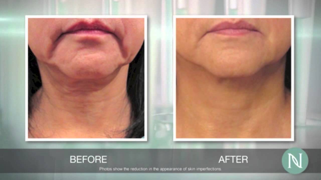 Nerium Skin Care Treatment - Home Based Business Opportunities