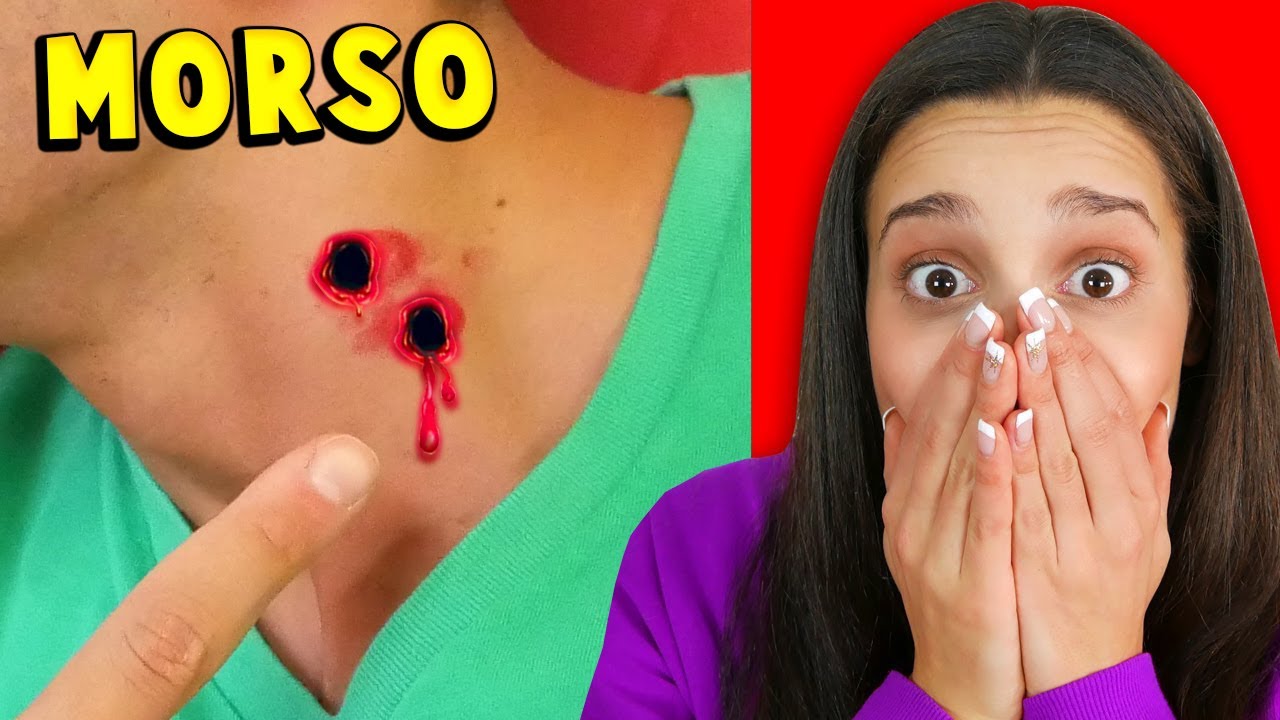 MOLLY È STATO MORSO DA UN VAMPIRO!!