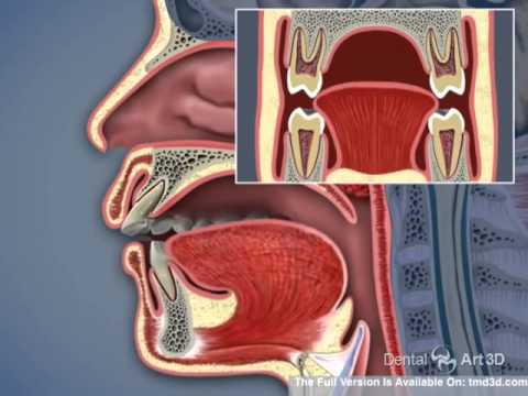 Airway and TMJ