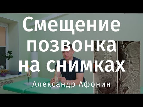 Видео: T3, изображения и изображения грудных позвонков T3 - Карты тела