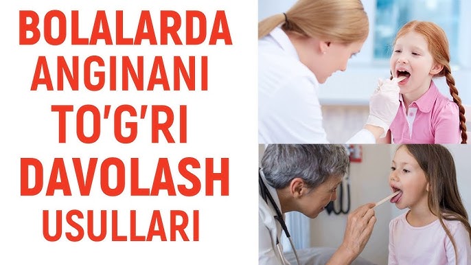 Katta xorozlar tomoq kompilyatsiyasi Katta xorozlar tomoq kompilyatsiyasi