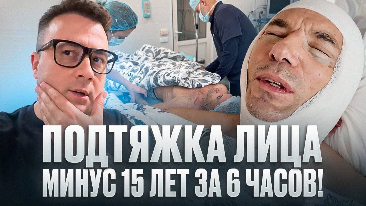 Подтяжка лица Артуру. Минус 15 лет за 6 часов!