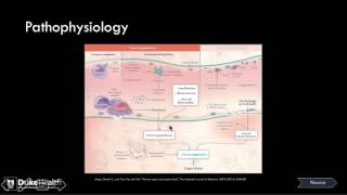 Brogan Sepsis 4/7