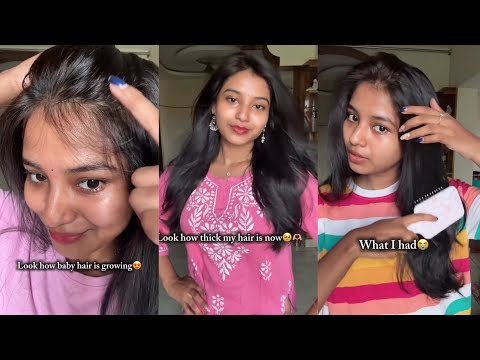 Hair growth update ❤️👧🏻 || The results speak for themselves 😭🌱💁🏻‍♀️ || Comment "GROW" for the link🔗💖