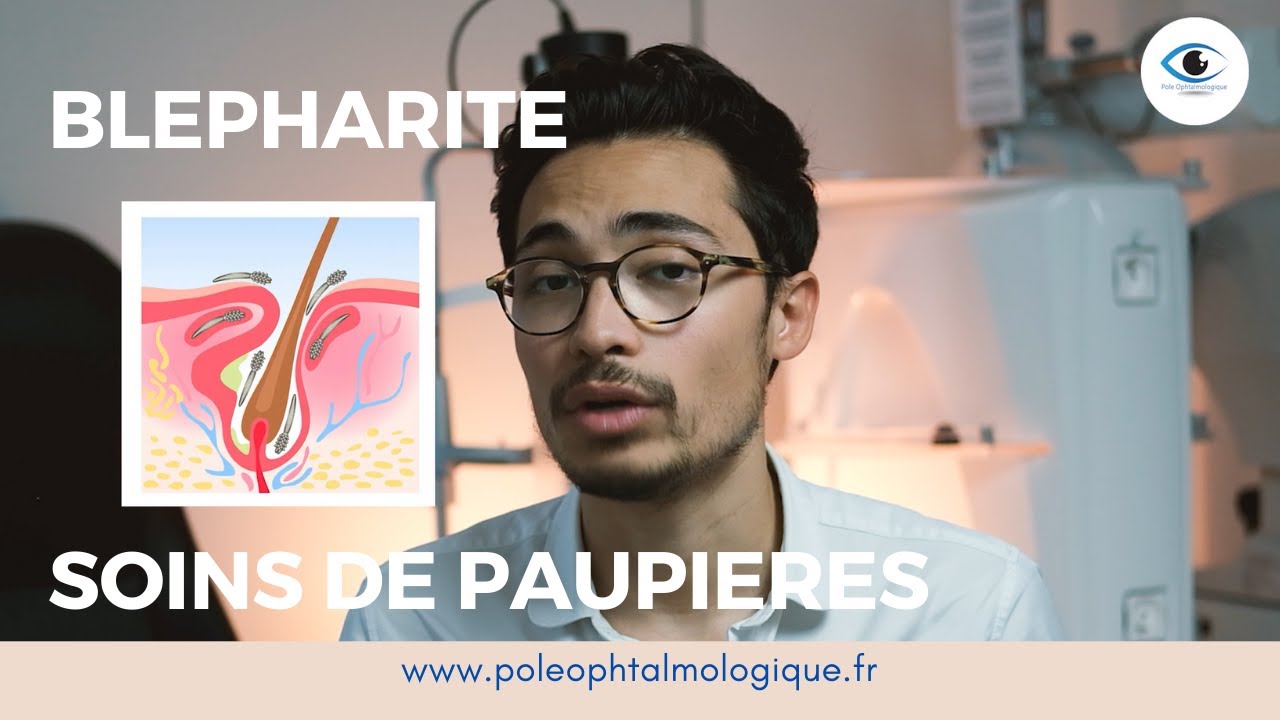 Paupières Rouges Blépharite - soins de paupières - Pole Ophtalmologique - YouTube
