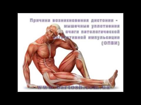 Вегето сосудистая дистония