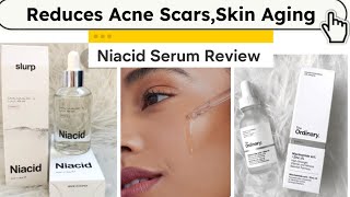 Niacinamide Serum | Niacid Serum | The Ordinary Niacinamide Serum Review | Acne Scars Serum | Niacid