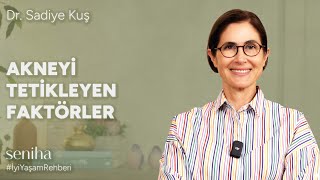 Akneyi Tetikleyen 13 Alışkanlık Farkında Olmadan Yaptıklarınız