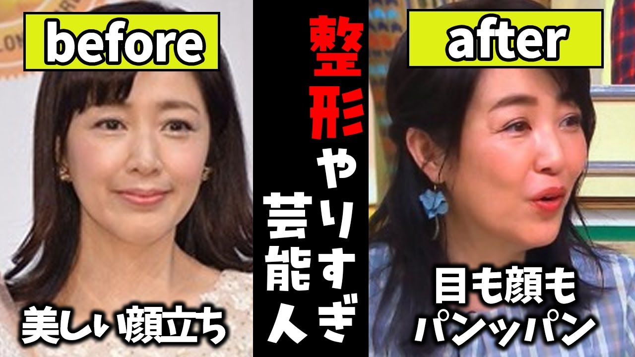 【ガルちゃん芸能】違和感しかない...整形に取り憑かれた芸能人【有益2ch】