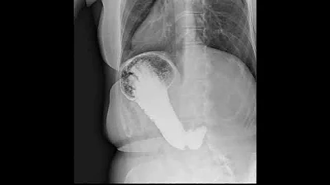 Dynamic X-Ray Retrospective View of Abdominal Motion | Konica Minolta Healthcare