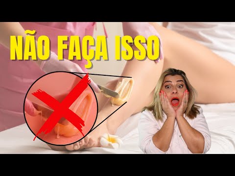 Vídeo: Bunda Peluda: Causas, Tratamento E Depilação