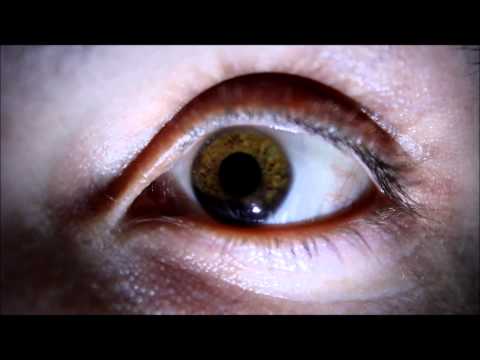 my iris