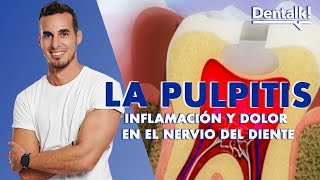 ¿Dolor intenso de muela? Podría ser PULPITIS - Tratamiento INFLAMACIÓN NERVIO dental | Dentalk! ©