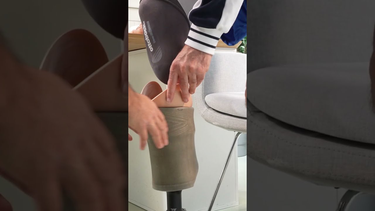 Below Knee Prosthesis With Active Vacuum System