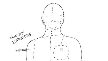 What is AAV and how does it work?