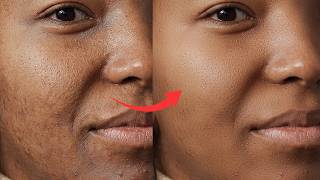 Fix & Remove Blemishes From Photos  Using Adobe Photoshop screenshot 5
