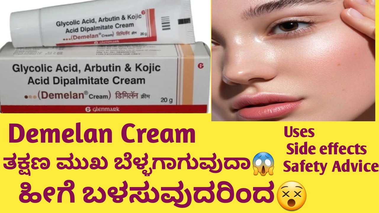 Demelan Cream Review in kannadaUsesಮುಖ ಬೆಳ್ಳಗಾಗುವ CreamNo Side
