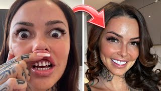 Jai Refait Mes Dents Changement Intense