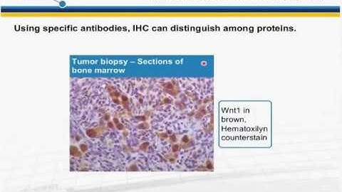 Immunohistochemistry IHC principles and troubleshooting