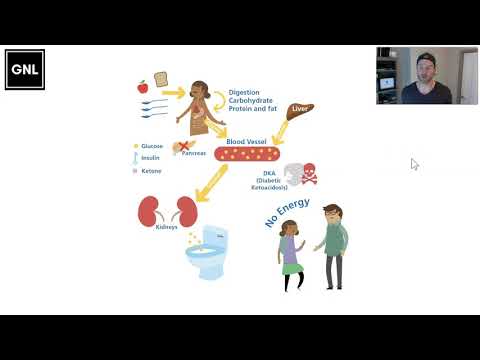 01 Foundations: What is Diabetes (www.theglucoseneverlies.com)