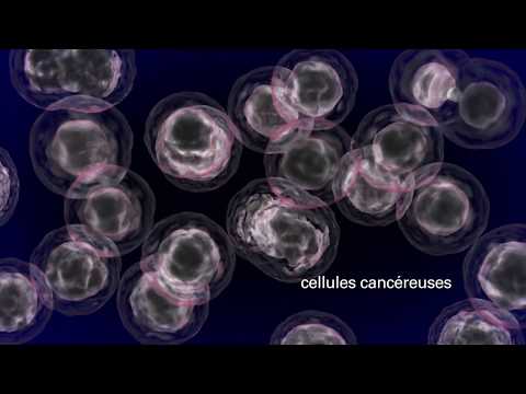 Vidéo: 3 façons de diagnostiquer le cancer du sein