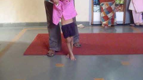 child with cerebral palsy before injection of botulinum toxin A