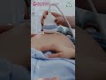 Does Ultrasound Harm Your Baby? Here’s The Truth Every Mom Must Know! 🩺👶 | Shri Shakti Hospital