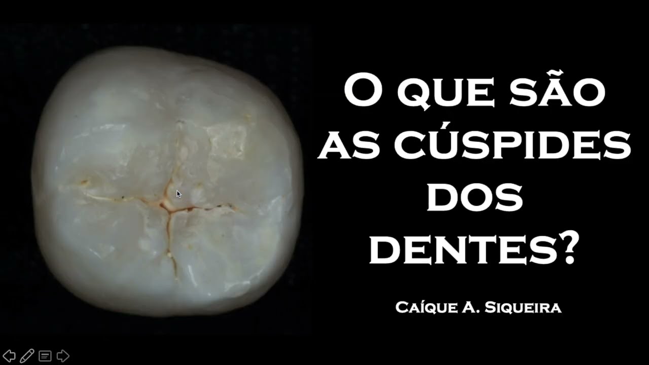 O que são as cúspides dos dentes? Anatomia Dental YouTube