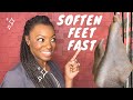 Soften Heels-4 Quick Tips to get rid of dry skin on feet