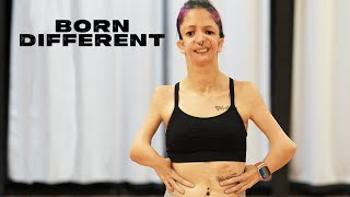 Only 93 People In The World Have My Condition | BORN DIFFERENT