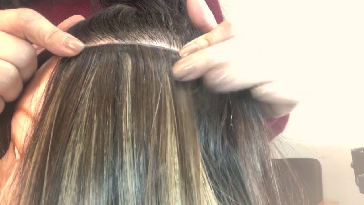 APLICAÇÃO CORRETA DO MÉTODO ADESIVO (INVISÍVEL)