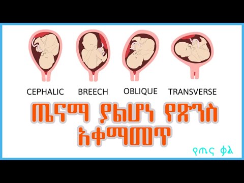 ቪዲዮ: ቅድመ-አቀማመጥ ቢኖርም እንዴት ነው?