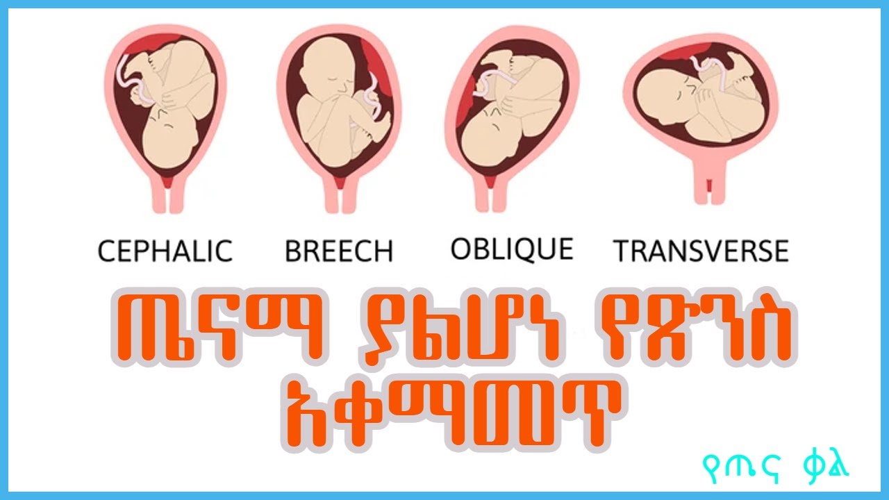 ጤናማ ያልሆነ የጽንስ አቀማመጥ || የጤና ቃል