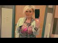 9 Years Gastric Bypass Update