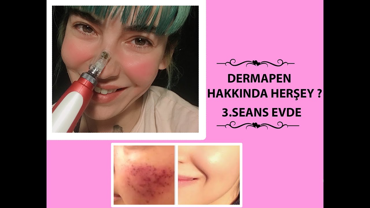 evde dermapen dermapen nedir 3 seans youtube