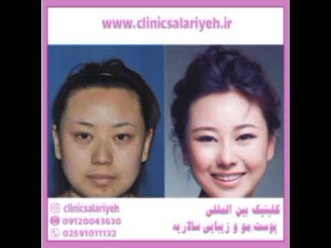 علت لاغر شدن صورت