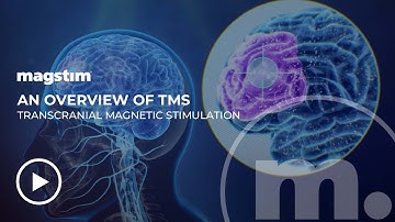 Magstim - An overview of TMS (Transcranial Magnetic Stimulation)