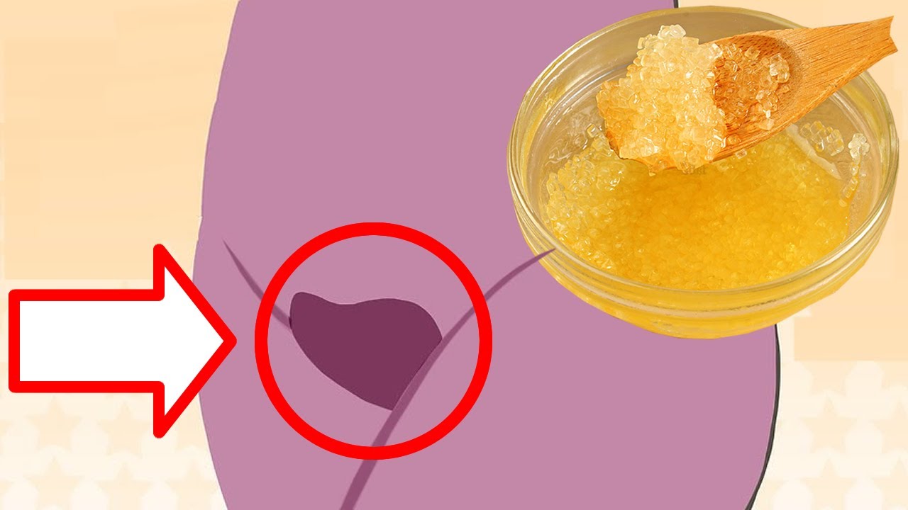 Remove Pubic Hair Permanently Pubic Hair Removal Home Remedies