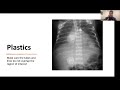 Neonatal Xray by Dr Tarun