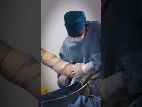 #problemas  en la #rodilla  Derecha #shorts