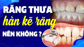 Hàn Kẽ Răng Để Hết Răng Thưa | Có Nên Không? | Nam Bui Vinalign