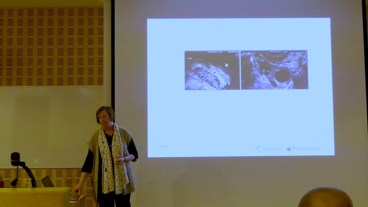Miten lapsettomuutta voidaan hoitaa? Anna Kivijärvi, Ovumia Fertinova