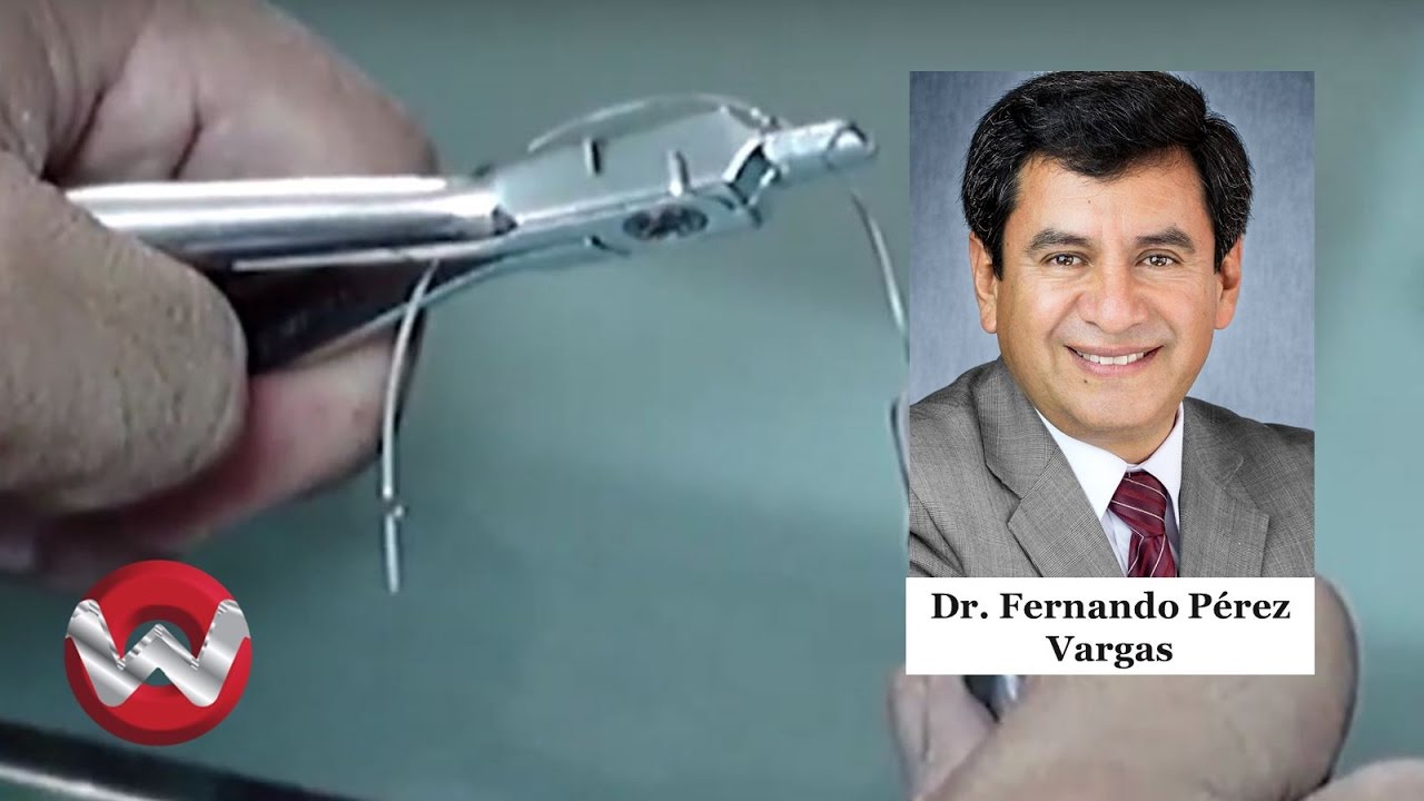 Realización de Torques en el Arco Rectangular