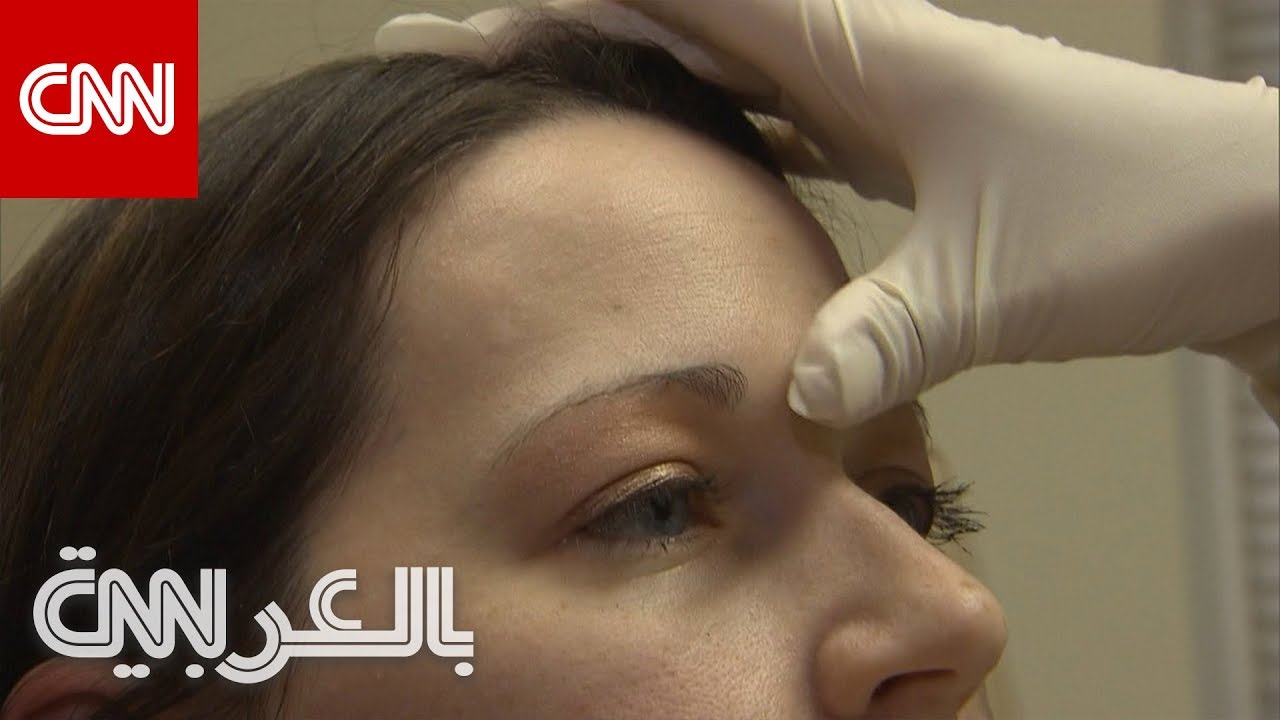 5 نصائح يجب على مرضى الصدفية مراعاتها في خطة العلاج