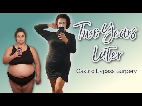 2 years after GASTRIC BYPASS SURGERY | Feat. Ana Luisa jewelry