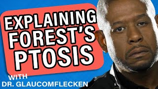 Starry Eyes: Forest Whitaker's Ptosis Explained | Knock Knock Eye