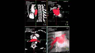 Multimodal Imaging