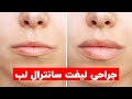 جراحی لیفت سانترال لب یا بالا کشیدن لب ها